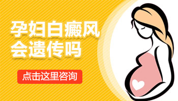 孕妇长的白癜风会不会长到孩子身上