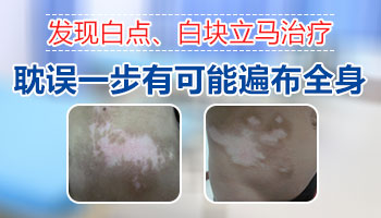 脚脖子有一小片白斑比以前大了是什么