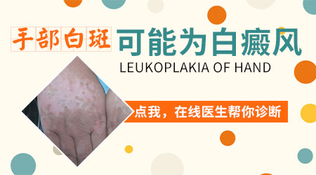 小孩子手背上长小白色点点