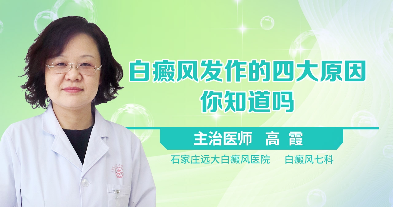 白癜风发作的四大原因你知道吗