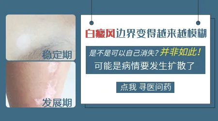 白斑边界越来越模糊是要扩散了吗
