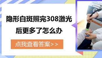 伍德灯照出隐形白斑怎么治疗好