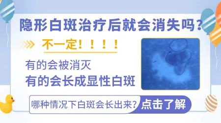 隐形白癜风能不能照激光治疗