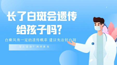 担心白癜风遗传做染色体检查能检查出来吗