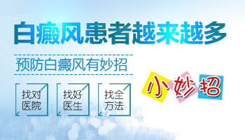 衡水肢端型白癜风怎么预防