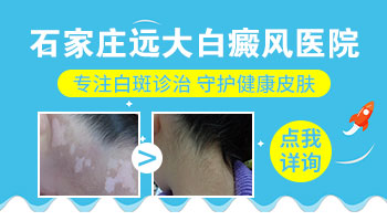 河北石家庄白癜风哪家医院好