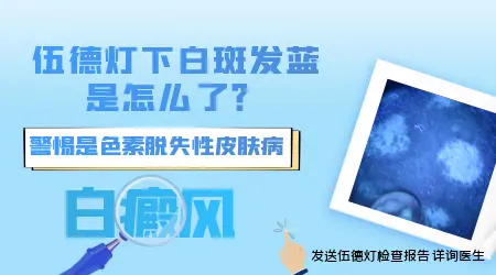 为什么不同医院伍德灯检查有的写蓝白有的写亮白