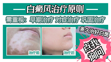 白癜风白斑能晒太阳吗 白癜风患者如何做好防晒