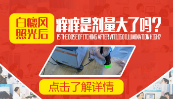 光疗仪治疗白癜风光照后发痒