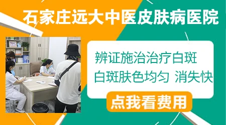 石家庄哪家医院治白癜风厉害