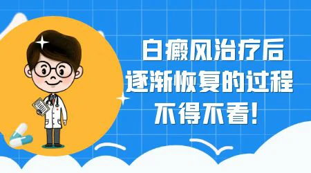 肢端型白癜风使用芦可替尼有效吗