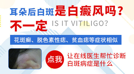 耳朵旁边有一块特别明显的白斑是什么