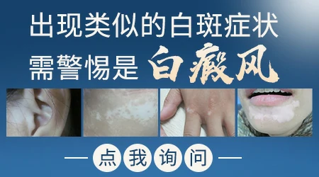 脖子上出现亮白的斑点是怎么回事