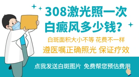 石家庄白癜风专科医院照一次308激光多少钱