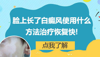 脸上白癜风有一个多月了怎么治疗好