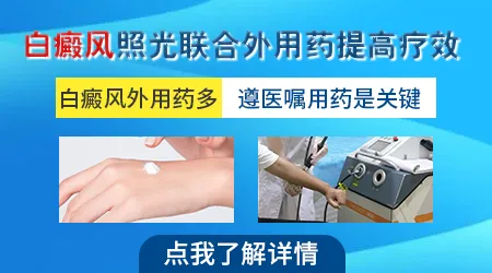 白癜风治疗用308激光还是紫外线UVB好