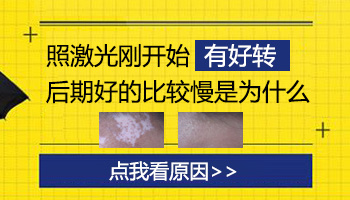 多年的白癜风照光有耐光性了怎么办