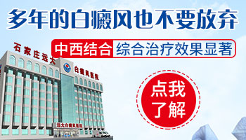 治疗白癜风要多长时间 综合治疗速度快还抗复发