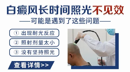 308激光照了一年半白斑还要照吗