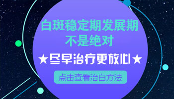白癜风延缓发展还用治疗吗