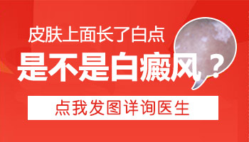 皮肤刚出现白斑如何诊断是不是白癜风