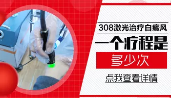 激光治疗白癜风多久一个疗程
