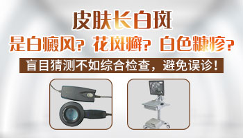 儿童皮肤白斑的图片 皮肤白斑怎么治