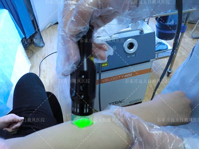 白癜风照308后能不能照311