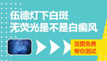 伍德灯提示白色荧光是什么意思