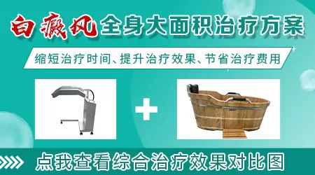 全身仓照白癜风不红怎么回事