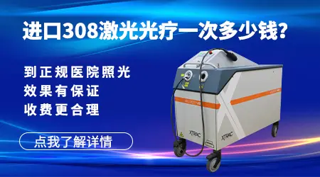 石家庄照308准分子激光价格 按什么收费