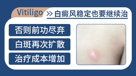 过年期间白癜风患者能喝点酒吗