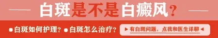 额头白癜风图片 白斑能治好吗