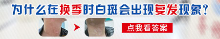 脸上白癜风治好了又变白怎么办