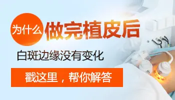 白癜风做了种植手术边缘还有一圈白