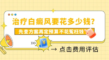 硬币大白癜风治疗下来要多少钱