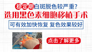 白斑稳定两年了能做皮肤移植手术吗