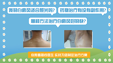 吃什么药物能抑制白癜风发展
