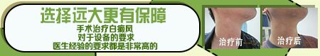 就医推荐:孩子硬币大小白癜风做移植手术行吗 多少钱