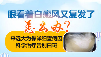 儿童白癜风有点复发的趋势怎么治
