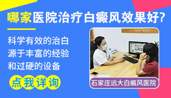 中国哪家医院治白癜风最好