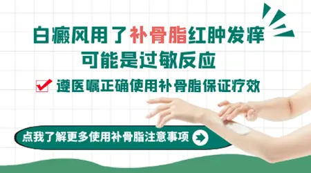 白斑用了补骨脂酊皮肤发痒正常吗