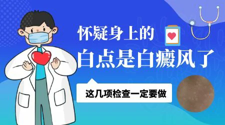 怀疑自己身上白斑是白癜风要做什么检查