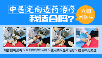 石家庄中医治疗白癜风医院
