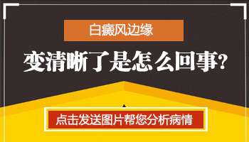 白癜风边缘又不清晰了好还是不好