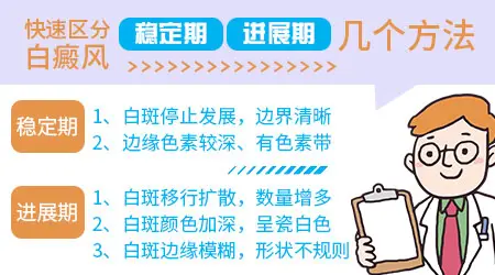 白癜风不再扩散是好了吗