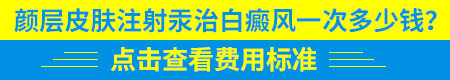 石家庄白斑治疗方法 石家庄怎么治白斑