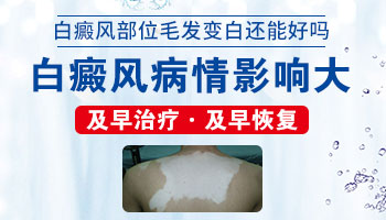 儿童白癜风早期毛发会变白吗