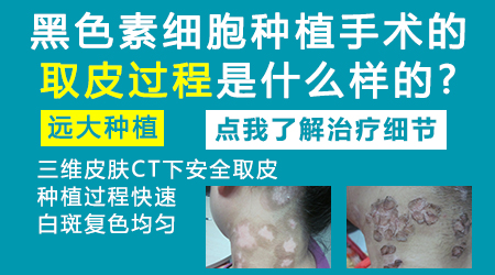 美国三维皮肤ct能查出什么