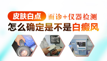 怎么确定白点是不是白癜风